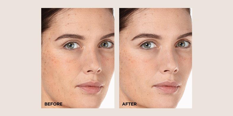 In Article Noncomedogenic Makeup And Skin Products VitaminCE